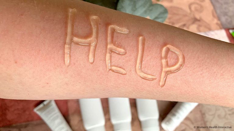 aerial photograph of irritated forearm with the word 